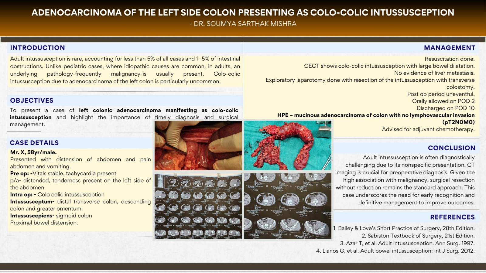 Rare case of left side colon adenocarcinoma presenting as colo-colic intussusception